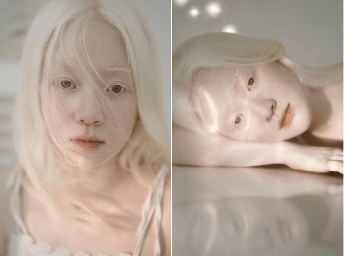 Sau khi gây chú ý qua bộ hình, Thúy Quỳnh chia sẻ nếu nhận được lời mời làm mẫu ảnh, cô sẽ không ngần ngại thử sức và ngoại hình đặc biệt sẽ là lợi thế giúp 9X gây ấn tượng cho người khác.