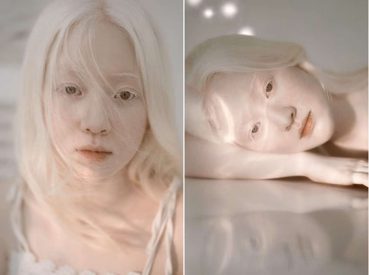 Sau khi gây chú ý qua bộ hình, Thúy Quỳnh chia sẻ nếu nhận được lời mời làm mẫu ảnh, cô sẽ không ngần ngại thử sức và ngoại hình đặc biệt sẽ là lợi thế giúp 9X gây ấn tượng cho người khác.