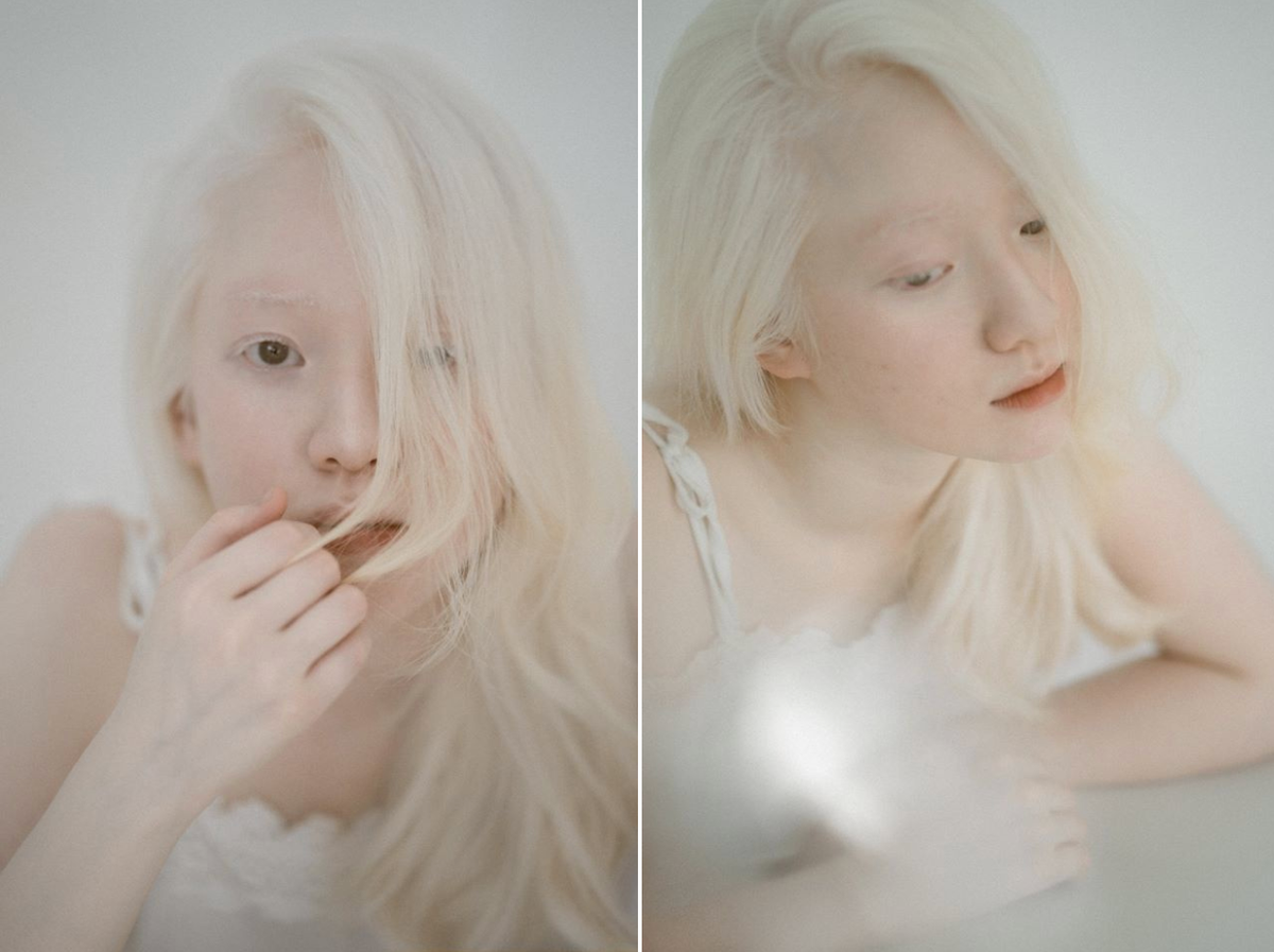 Diện chiếc váy trắng đơn giản, không làm tóc hay thậm chí chẳng trang điểm cầu kỳ, Thúy Quỳnh được nhận xét vẫn đem lại ấn tượng đặc biệt nhờ làn da, màu tóc trắng muốt do căn bệnh bạch tạng. 9X nói với Zing bộ ảnh được chụp vào 1/6, đây cũng là lần đầu tiên cô làm mẫu ảnh.