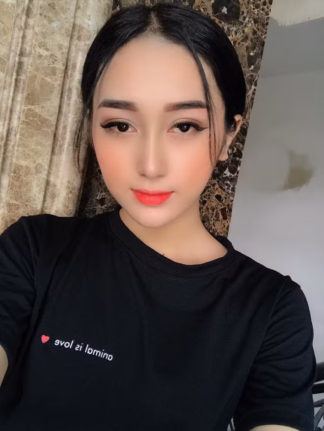 Cách đây một năm, khi bước sang tuổi 18, An Kim bắt đầu thực hiện các cuộc phẫu thuật chuyển giới và phẫu thuật thẩm mỹ để "lột xác" thành một con người hoàn toàn.