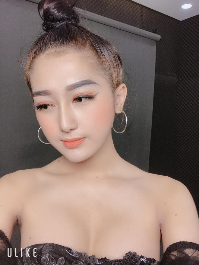 Được biết, chi phí cho các cuộc phẫu thuật lên đến gần 300 triệu đồng, An Kim cho hay tất cả đều do bố mẹ cô tài trợ.