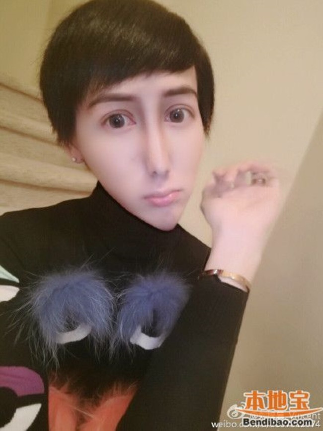 Năm 2017, anh chàng họ Lưu hứa nếu status của mình nhận được 100.000 lượt thích, anh ta sẽ đăng ảnh tiêm Hyaluronic Acid (một phương pháp làm đẹp bằng filler thay thế tiêm botox để trẻ hóa làn da) toàn gương mặt của mình lên mạng.