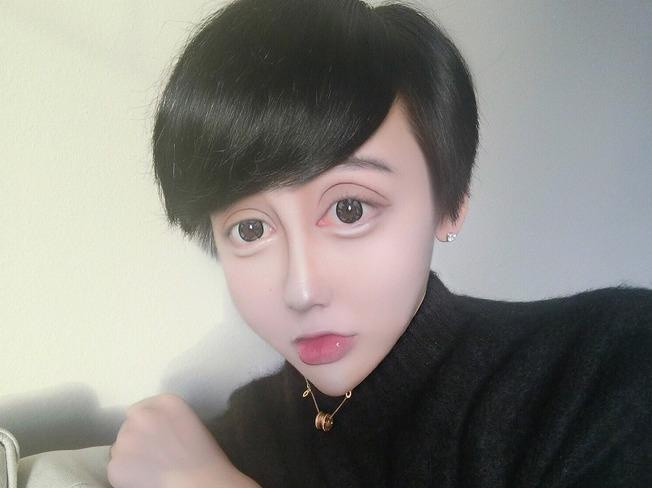 Khác hoàn toàn với những hình ảnh trước đó, Lưu Tử Thần ngoài đời có gương mặt sưng phù, làn da tối màu, đôi mắt híp khiến nhiều người không nhận ra.