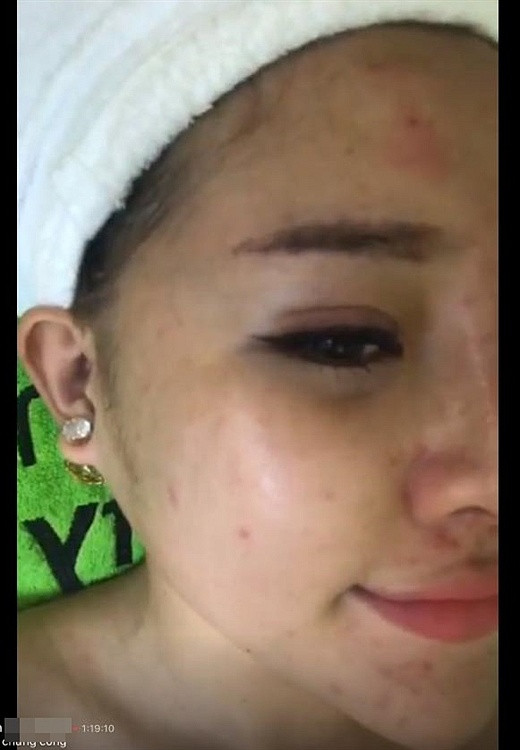 Nhan sắc đời thực của Ngân 98 khác xa những tấm hình selfie long lanh cô nàng từng đăng tải.