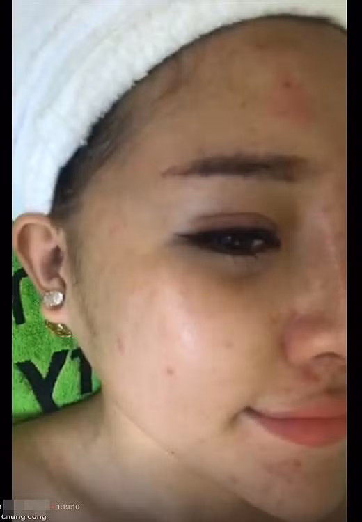 Nhan sắc đời thực của Ngân 98 khác xa những tấm hình selfie long lanh cô nàng từng đăng tải.