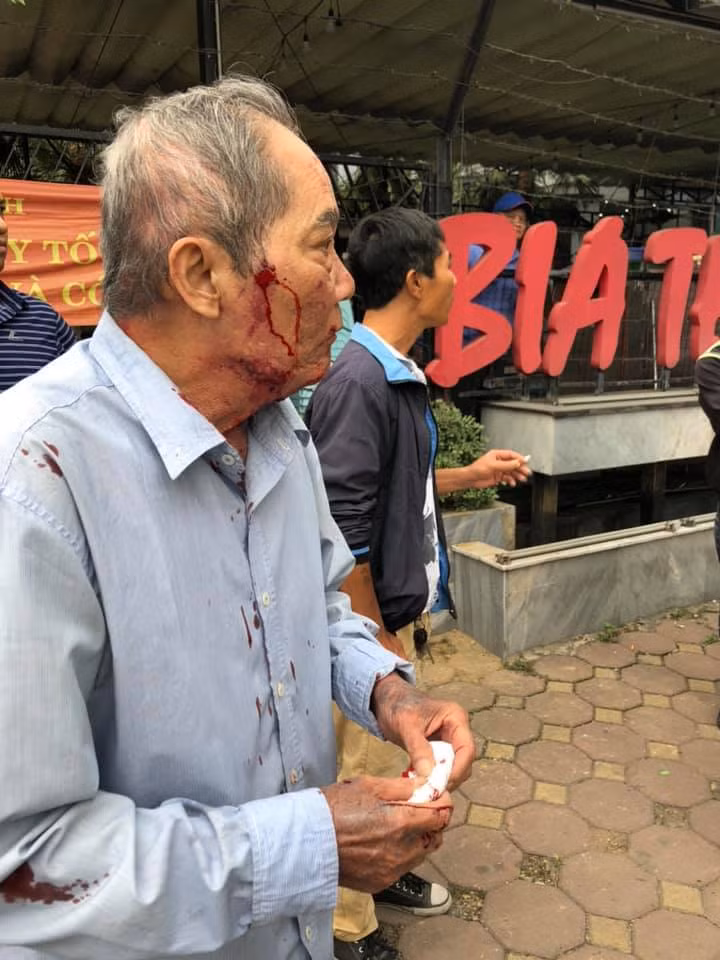 Theo một nhân chứng, ông Lâm bị tên xe ôm côn đồ dùng súng cao su tự chế bắn vào người và đấm liên tục vào mặt. Nếu không có nhiều người can ngăn không biết ông cụ sẽ còn bị đánh ra sao.
