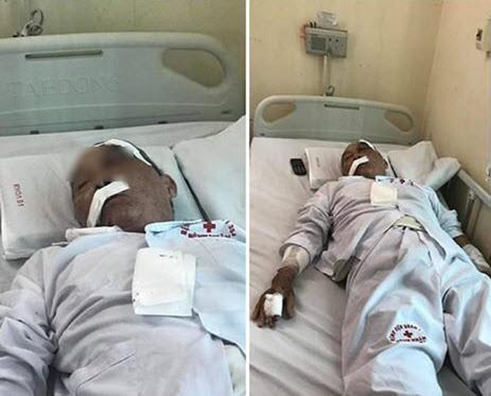 Hiện Công an phường Cống Vị đã vào cuộc, tạm giữ đối với Phạm Ngọc Lân để lấy lời khai.