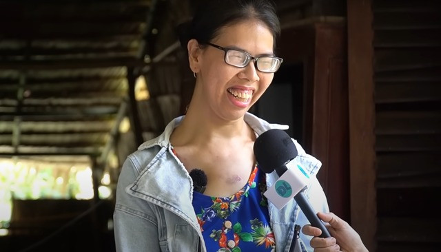 Từ nhỏ đến lớn, vì chiều cao khác người nên cô gái không hề có lấy 1 người bạn nào.