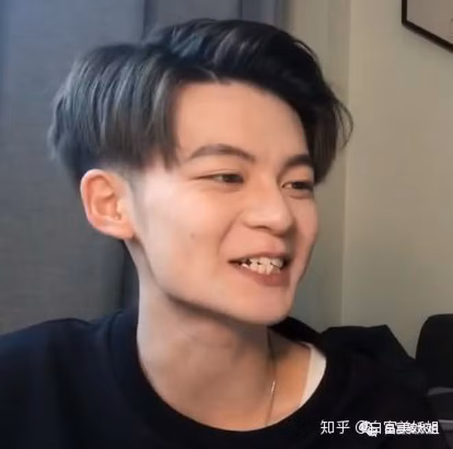 Mũi to, đôi mắt nhỏ, khuôn mặt gầy gò cùng đôi môi mỏng, răng khấp khểnh của Mặc Phi khiến nhiều cô gái "chết đứng". Ngay sau đó, lượng theo dõi anh chàng đã giảm không thương tiếc. "Ai đây? Nam thần Mạc Phi đây ư? Trời ơi, không thể tin được", "Tôi cảm thấy như là mình đang bị lừa đảo vậy" - Dân mạng bình luận.