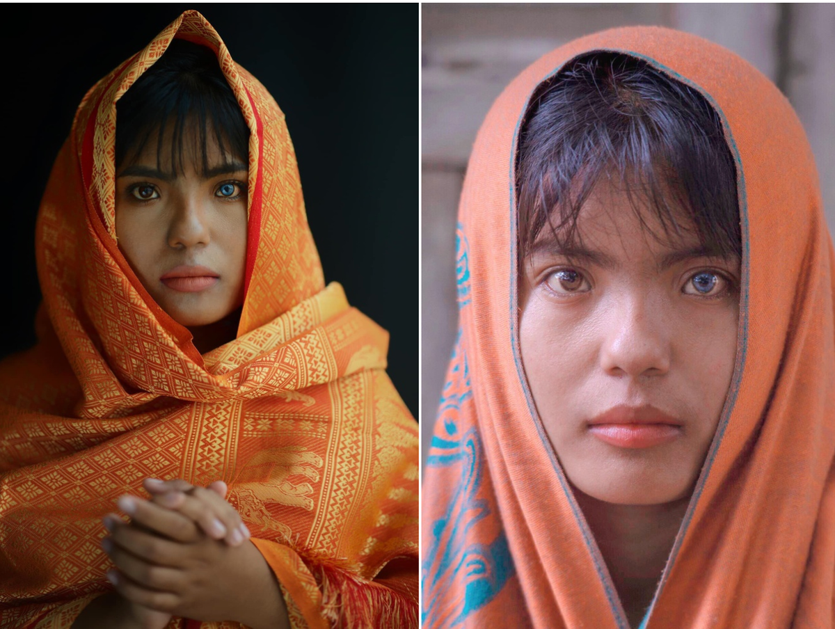 Chia sẻ với Zing, SaPa cho hay hồi nhỏ, cô từng cảm thấy buồn và xấu hổ khi đi học bị bạn bè trêu chọc là “mắt mèo”. Cũng vì thế, trong các bức ảnh ngày trước, cô gái ít nở nụ cười, gương mặt lạnh lùng, hiếm khi dám nhìn thẳng vào ai. "Vì còn nhỏ, mình không hiểu đôi mắt là điểm khác lạ và cuốn hút trên mặt, chỉ biết rằng nó khiến mọi người tò mò, chỉ trỏ khi mình ra đường", cô giải thích.