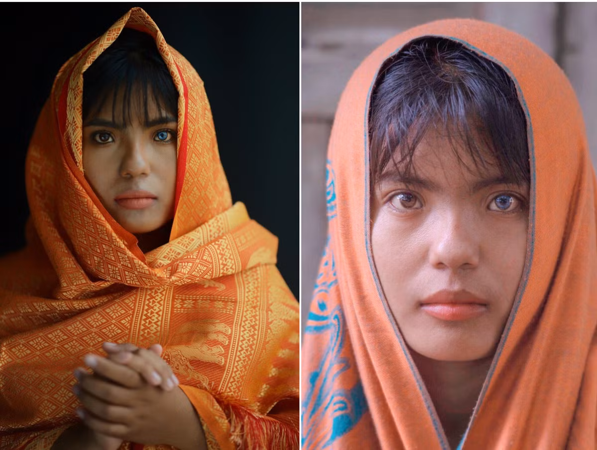 Chia sẻ với Zing, SaPa cho hay hồi nhỏ, cô từng cảm thấy buồn và xấu hổ khi đi học bị bạn bè trêu chọc là “mắt mèo”. Cũng vì thế, trong các bức ảnh ngày trước, cô gái ít nở nụ cười, gương mặt lạnh lùng, hiếm khi dám nhìn thẳng vào ai. "Vì còn nhỏ, mình không hiểu đôi mắt là điểm khác lạ và cuốn hút trên mặt, chỉ biết rằng nó khiến mọi người tò mò, chỉ trỏ khi mình ra đường", cô giải thích.