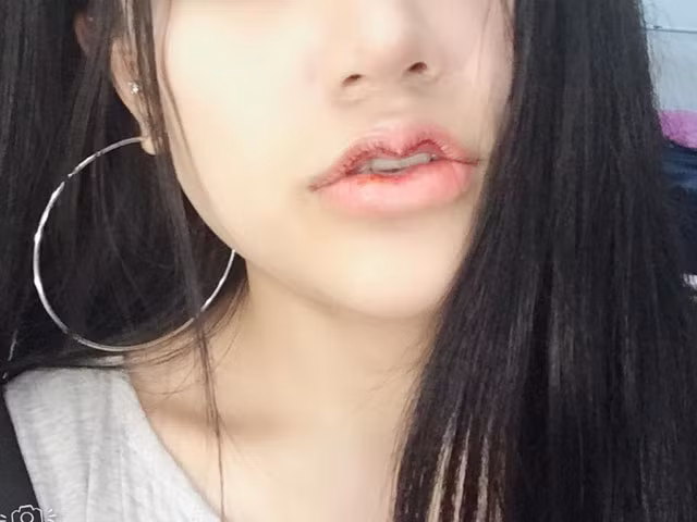 Giữa năm 2019, trào lưu làm đẹp kỳ lạ của hội chị em là tạo hình "môi mazda" hay còn có tên gọi khác là "môi hở răng lạnh" xuất hiện khiến nhiều người tá hỏa. Để sở hữu được đôi môi này, rất nhiều người đã phải bỏ ra một khoản tiền khá lớn để can thiệp thẩm mỹ.