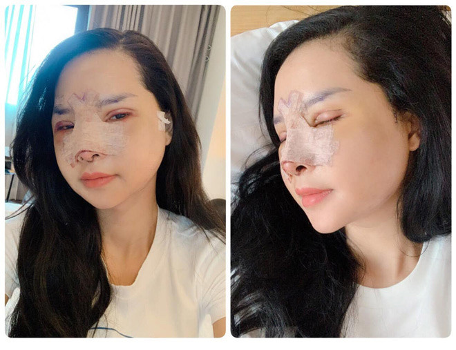 Có vài lần, khi được chồng hỏi khi giàu sẽ làm gì, chị Hạnh đều trả lời: "Em muốn đập mặt đi xây lại được không anh?". Mặc dù chồng chị luôn nói rằng: "Em đẹp rồi, đẹp nữa để lấy thêm chồng à?" nhưng bà mẹ bỉm sữa vẫn nung nấu ước mơ thay đổi diện mạo.