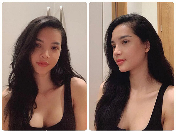 Khi bất ngờ được chồng đưa cho cuốn sổ tiết kiệm và được quyền "toàn quyền sử dụng theo ý muốn", chị Hạnh đã ngay lập tức xin chồng cho đi phẫu thuật, thực hiện ước mơ của mình.