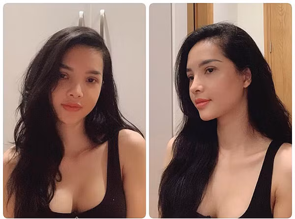 Khi bất ngờ được chồng đưa cho cuốn sổ tiết kiệm và được quyền "toàn quyền sử dụng theo ý muốn", chị Hạnh đã ngay lập tức xin chồng cho đi phẫu thuật, thực hiện ước mơ của mình.