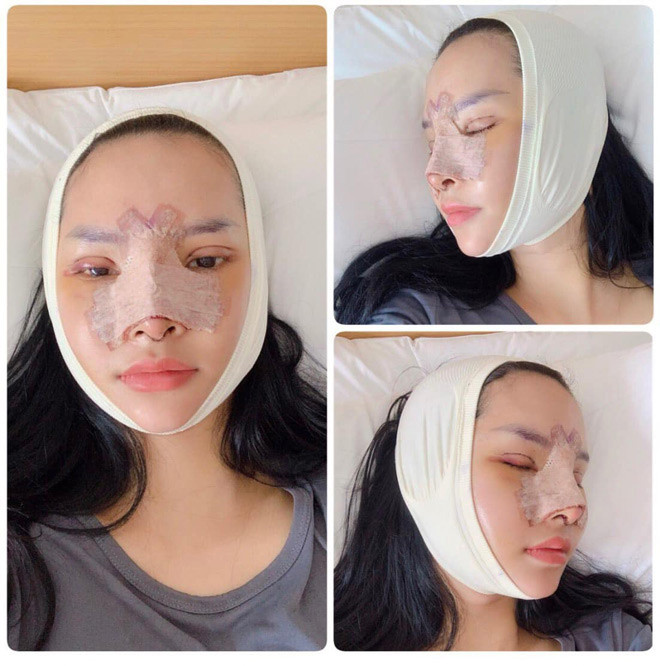 Chị Hạnh chia sẻ, khoảng thời gian đó chỉ ước mơ như vậy chứ biết khi nào mới giàu, vài trăm triệu để tân trang nhan sắc là con số không hề nhỏ. Đặc biệt là chị chỉ ở nhà chăm con và tiêu tiền của chồng thì ước mơ gần như là không thể thực hiện được.