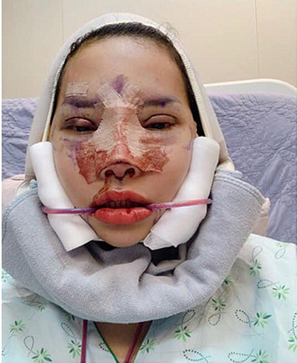 Phụ nữ hiện đại ai cũng muốn đẹp lên để tự tin hơn, chính vì vậy, phẫu thuật thẩm mỹ là phương pháp nhanh chóng và hiệu quả được nhiều chị em tìm tới. Tuy nhiên, không phải ai cũng can đảm "đập đi xây lại" toàn bộ khuôn mặt giống như bà mẹ bỉm sữa tại Hà Nội này.