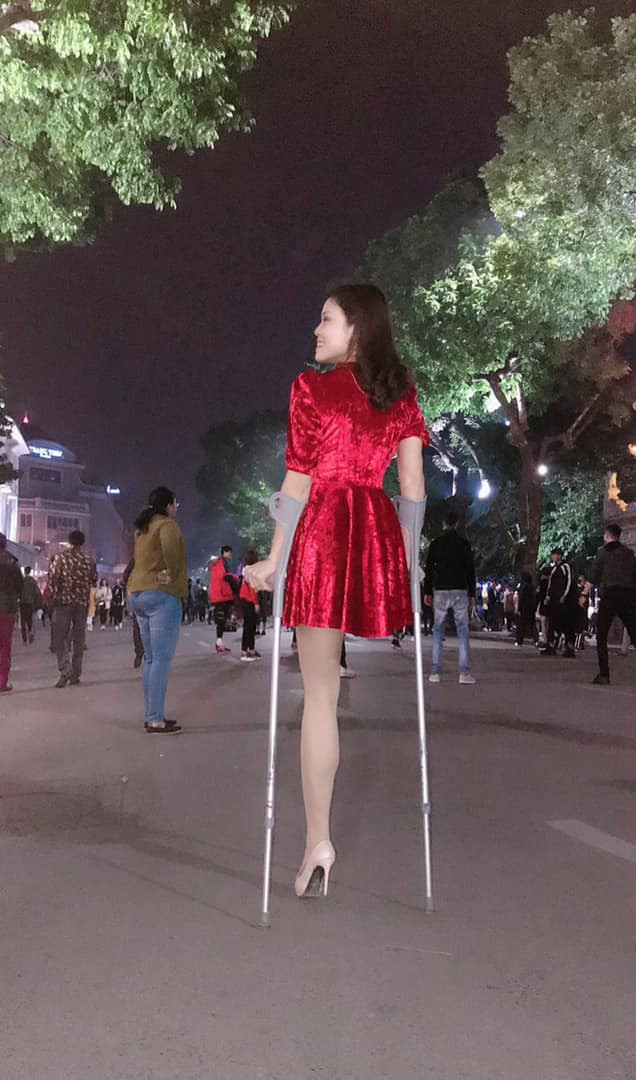 Mới đây, nhiều fanpage lớn trên mạng xã hội chia sẻ thông tin về cô gái cụt một chân đầy nghị lực, luôn lạc quan và yêu đời thu hút sự chú ý của cộng đồng.