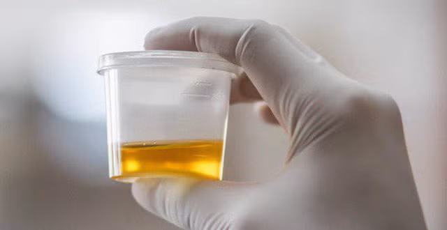 4 dau hieu canh bao benh sau khi uong nuoc, neu co can kham gap