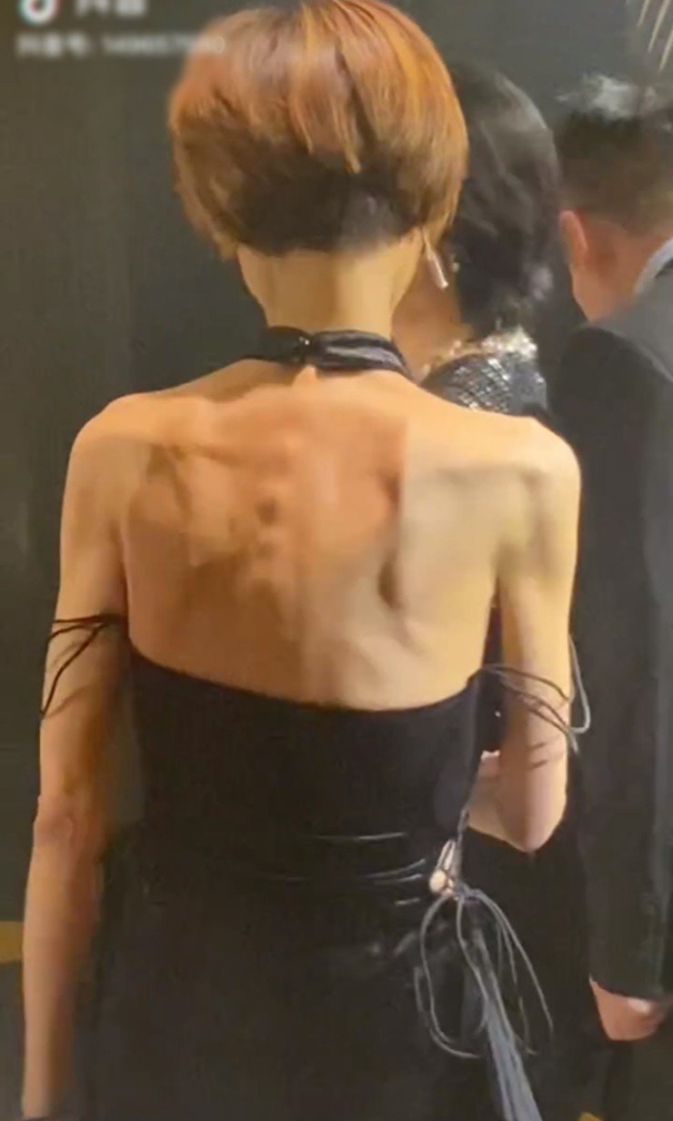 Lưng trần gầy guộc...