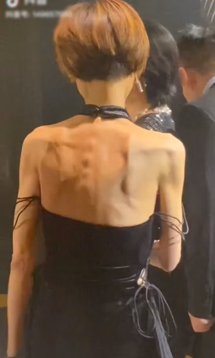 Lưng trần gầy guộc...