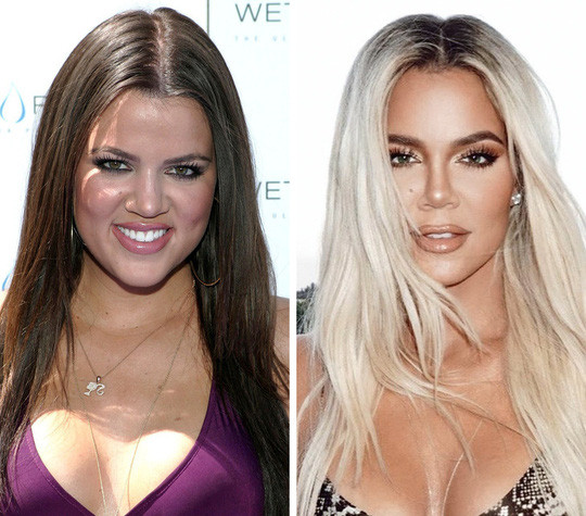 10 năm trước, Khloe Kardashian có gương mặt to, thân hình đồ sộ. 10 năm sau cô không khác nhiều về đường nét, nhưng vóc dáng thon thả hơn. Mái tóc sáng màu giúp cô ăn gian được tuổi thật một cách hiệu quả.