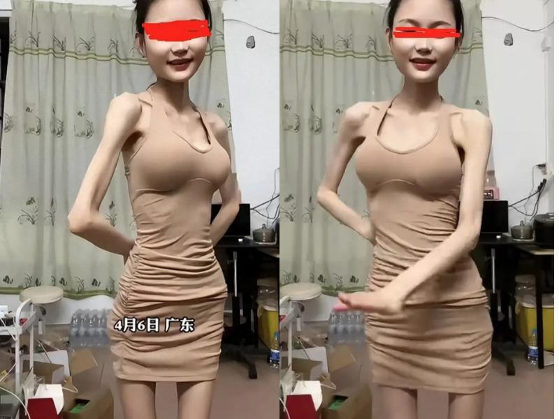 Rất nhiều người dùng mạng bày tỏ ý kiến cho rằng, việc thân hình quá mức “cò hương” như cô gái khiến người xem phải lo ngại và không hề đẹp chút nào: "Cứ như bộ xương di động vậy, không biết đẹp chỗ nào", "như này là giảm cân cực đoan quá rồi, dễ gặp phải vấn đề về sức khỏe lắm".