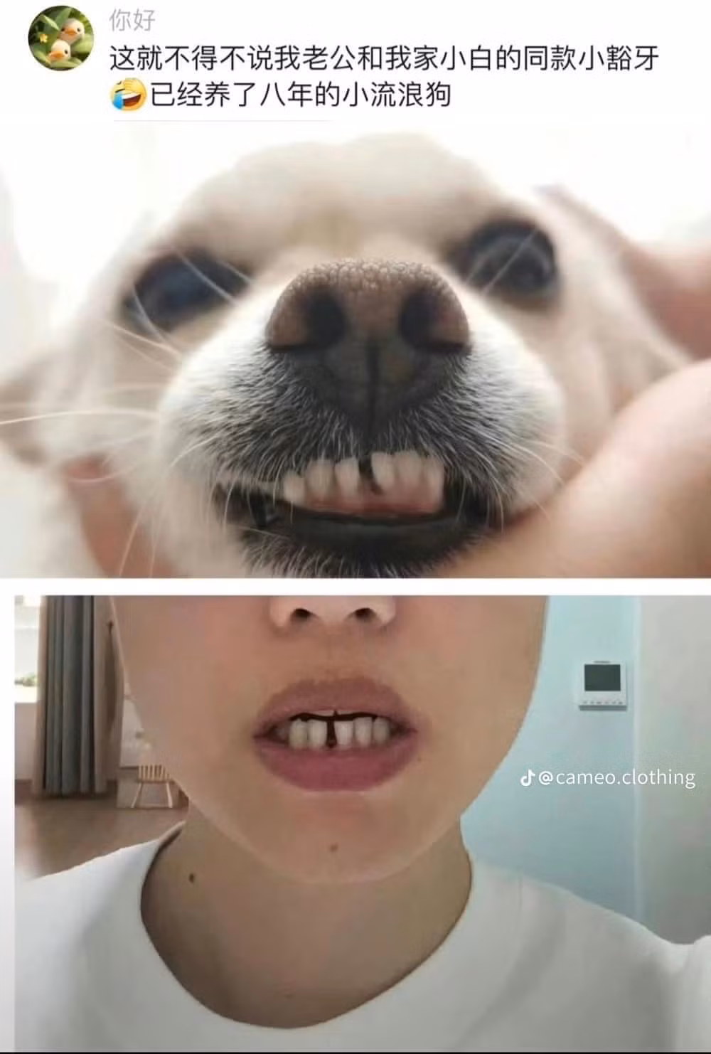 Đến cả răng thưa cũng giống nhau.