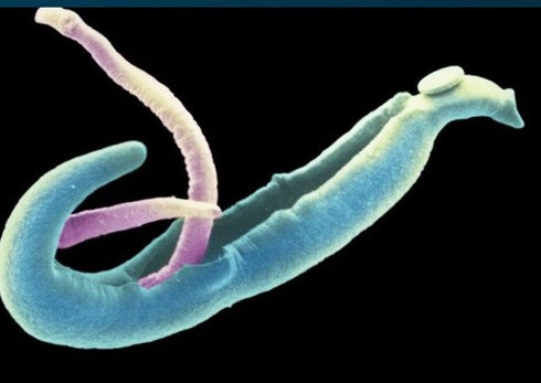 Diem mat 4 con “quai vat” trong co the ban