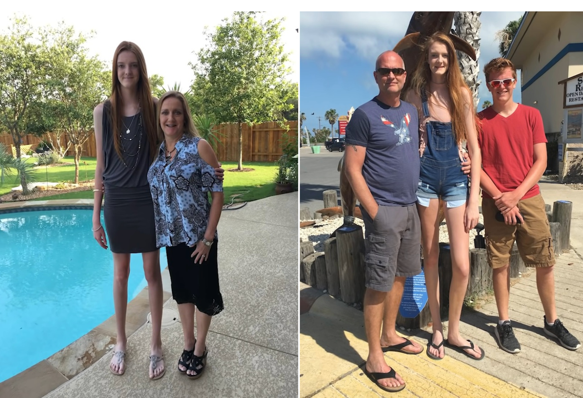 Maci được thừa hưởng gen chiều cao từ gia đình nhưng phát triển vượt trội hơn cả. 10X hiện là thành viên cao nhất nhà. Cụ thể, mẹ cô cao 1,7 m, bố 1,96 m và anh trai (17 tuổi) 1,91 m.