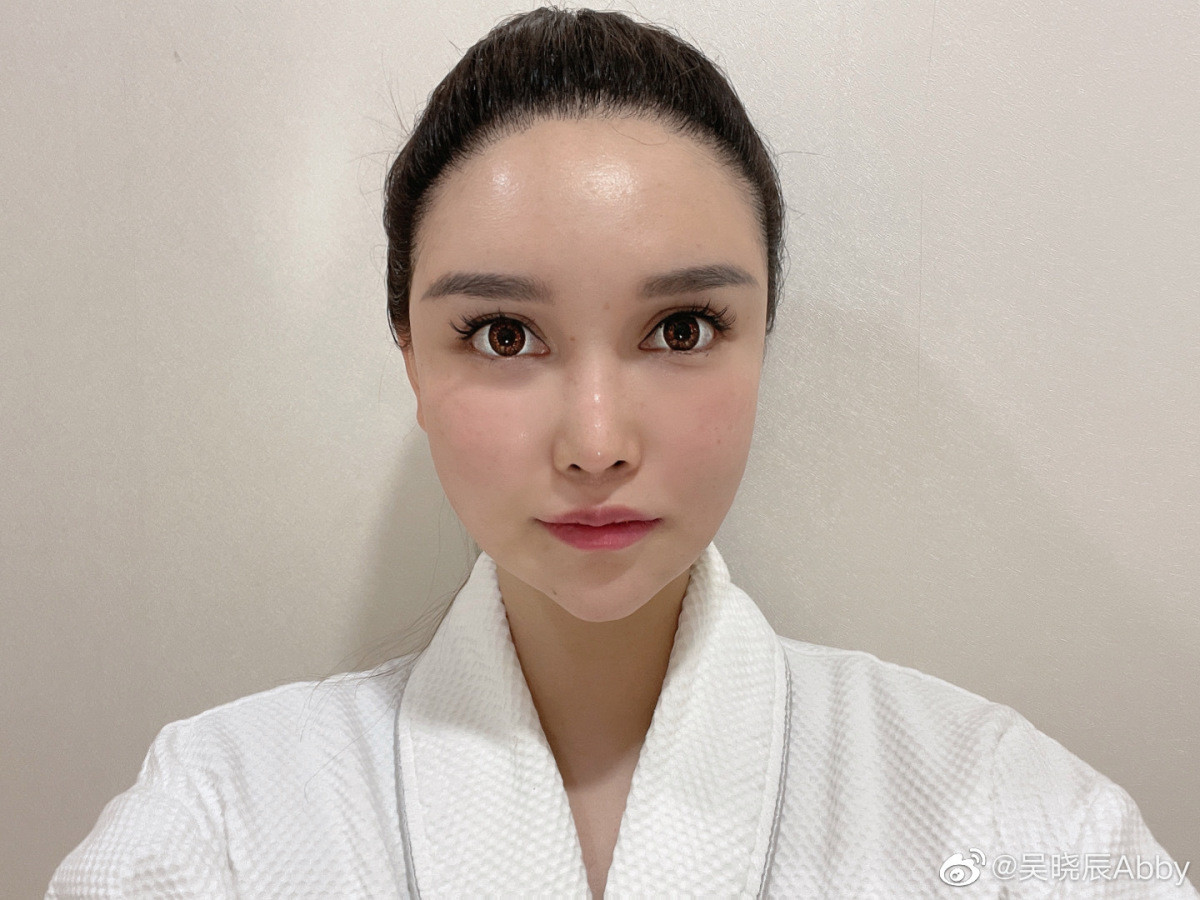 Tính đến năm 2020, Abby đã sửa mũi 6 lần, can thiệp vùng mắt hai lần, ba lần tạo dáng môi, ba lần nắn chỉnh dáng khuôn mặt, 4-5 lần cấy mỡ…