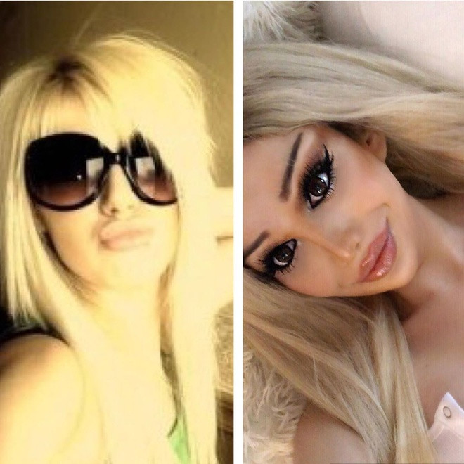 "Búp bê sống" 10 năm trước và hiện tại. Không ít người nhận xét gương mặt Barbara vốn đã xinh xắn song ngày càng đơ cứng và đáng sợ tỷ lệ thuận số lần dao kéo. Thông qua các bài đăng trên trang cá nhân, 9X bày tỏ cô hạnh phúc với vẻ ngoài của mình và được sống theo cách cô mong muốn.