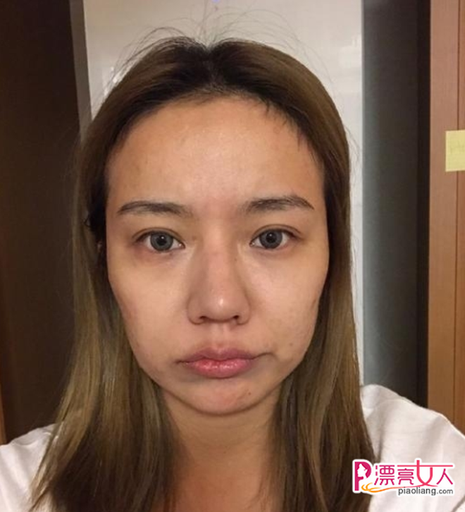 Bất chấp những chỉ trích từ cư dân mạng, Hiểu Dao tự tin đón nhận và đăng tải 1 loạt hình ảnh mặt mộc, không photoshop của mình.