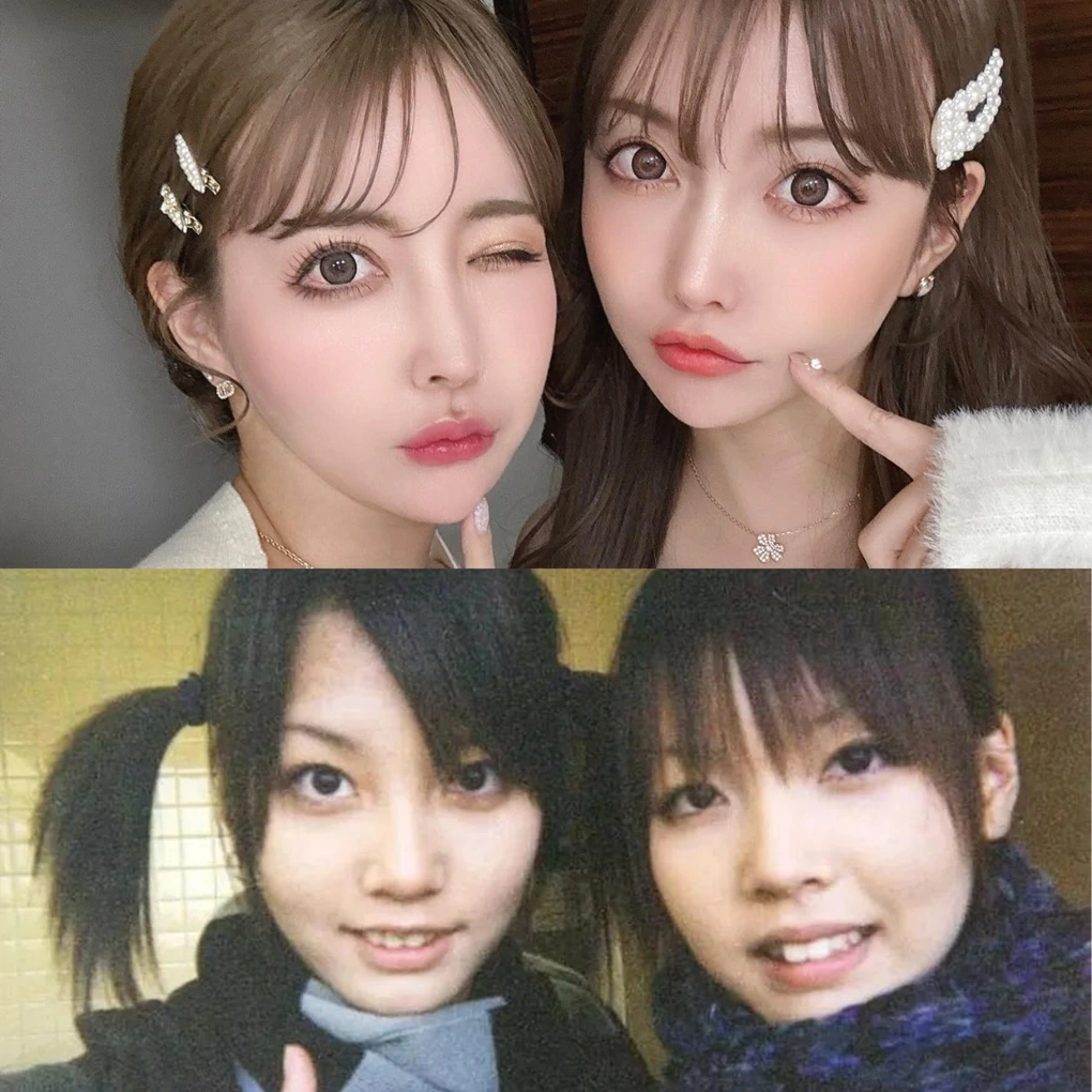 Hai cô nàng được cho là gương mặt đã có sẵn những đường nét thanh tú. Tuy nhiên, ngay từ khi còn nhỏ, hai chị em đã có ám ảnh về việc phải thay đổi ngoại hình. Sau mỗi lần nhan sắc bị so sánh với nhau, họ lại đứng trước gương và tìm kiếm những khuyết điểm trên gương mặt.