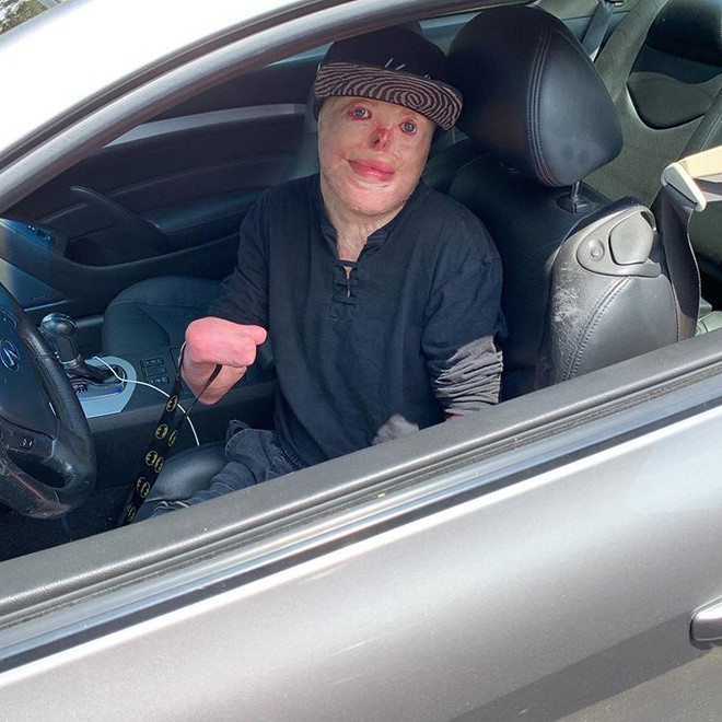 Thỉnh thoảng, Johnny cũng làm vlog để chia sẻ với mọi người góc nhìn về các vấn đề trong cuộc sống. Chàng trai cũng có sở thích cosplay và thích hóa trang thành quái nhân Deadpool. Nhờ nỗ lực tập luyện phục hồi chức năng, Johnny có thể tự mình làm nhiều việc, trong đó có lái ôtô. Dù cơ thể không còn lành lặn, anh được nhiều người xung quanh yêu mến nhờ thái độ sống tích cực và truyền cảm hứng.