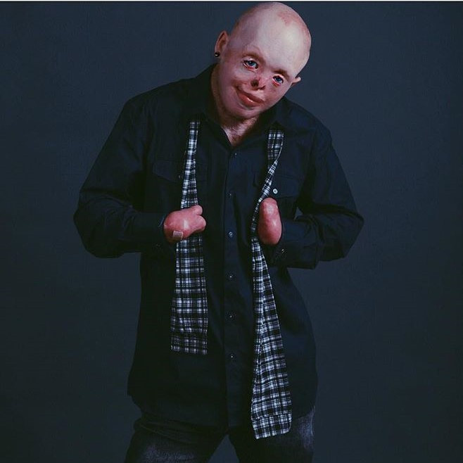 “Mãi sau tôi mới nhận ra mình ích kỷ đến thế nào. Rõ ràng là tôi có một gia đình yêu thương, quan tâm đến mình nhưng lại lờ đi điều đó”, Johnny nói. Cuối cùng, chàng trai nhận ra anh phải học cách yêu lấy bản thân trước khi sự thiếu tự tin hủy hoại con người mình.