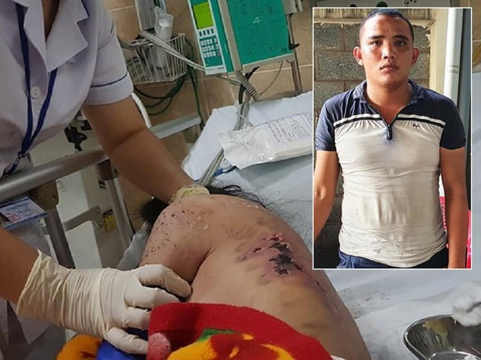 Loi khai cua ke tra tan nu nhan vien nhu thoi trung co vi tu choi kich duc