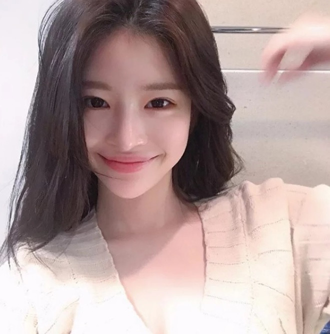 Bạn gái tin đồn của Seungri sở hữu nhan sắc xinh đẹp với đôi mắt to tròn, sống mũi cao và đôi môi căng mọng. Yoo Hye Won làm mẫu ảnh từ năm 18 tuổi và được biết đến là một hot girl mạng xã hội đình đám ở xứ sở kim chi.