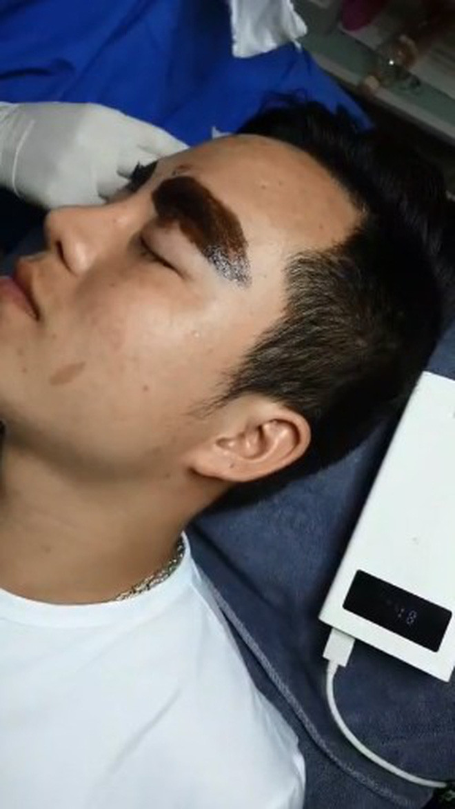 Cụ thể, cô dâu Thu Sao đã đưa chồng từ Cao Bằng xuống Hà Nội làm 1 cuộc đại phẫu chỉnh sửa khuôn mặt.