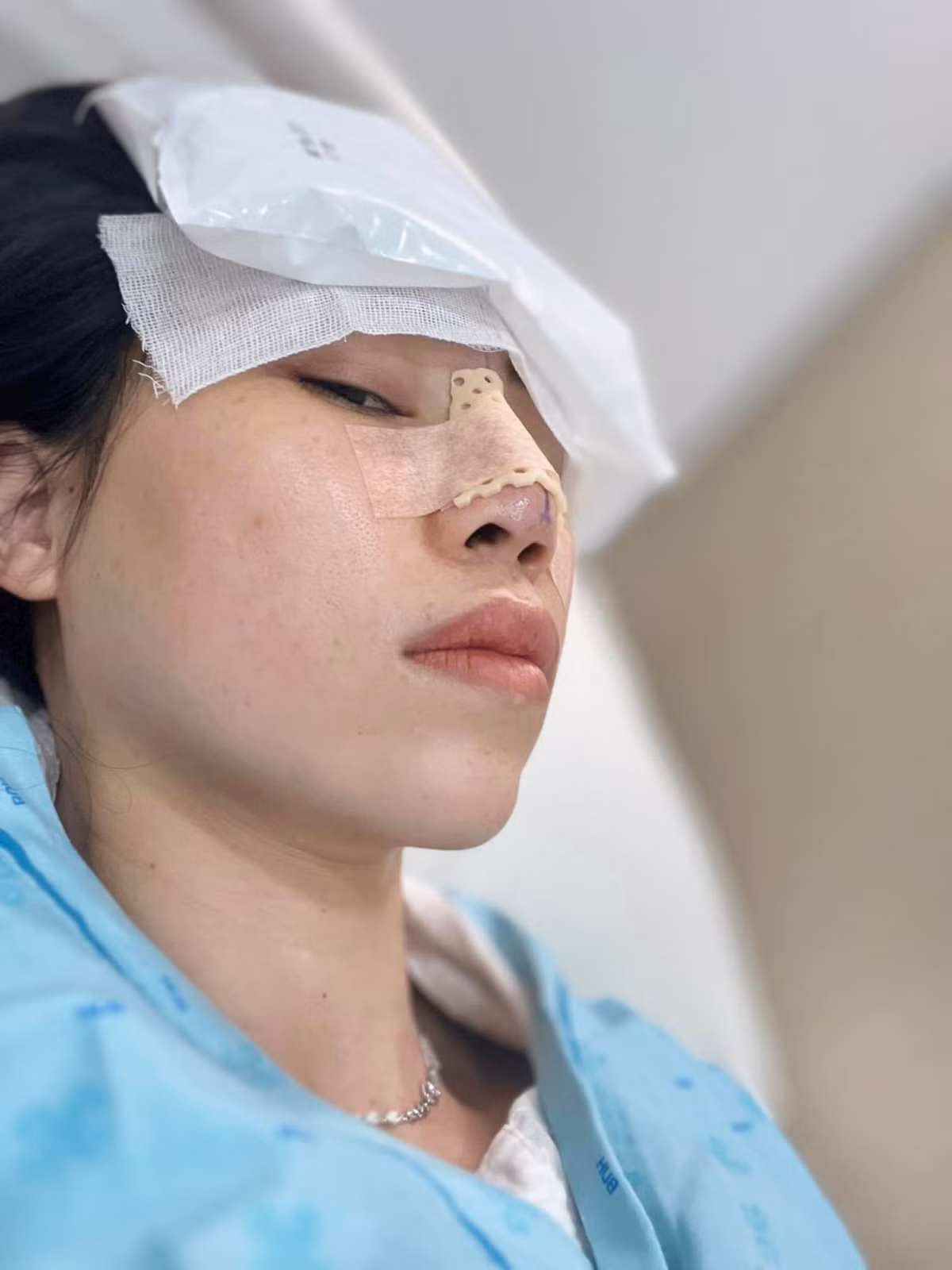 Cô không ngần ngại up lên trang cá nhân quá trình "đập mặt xây lại", cùng lời tuyên bố "4 tháng kể từ lúc giải nghệ t thay đổi hình ảnh luôn", hay "T sắp hỗn banh insta", T lên là để Hỗn, để mấy đứa ưa toxic người khác bớt tưởng mình là trung tâm đi".