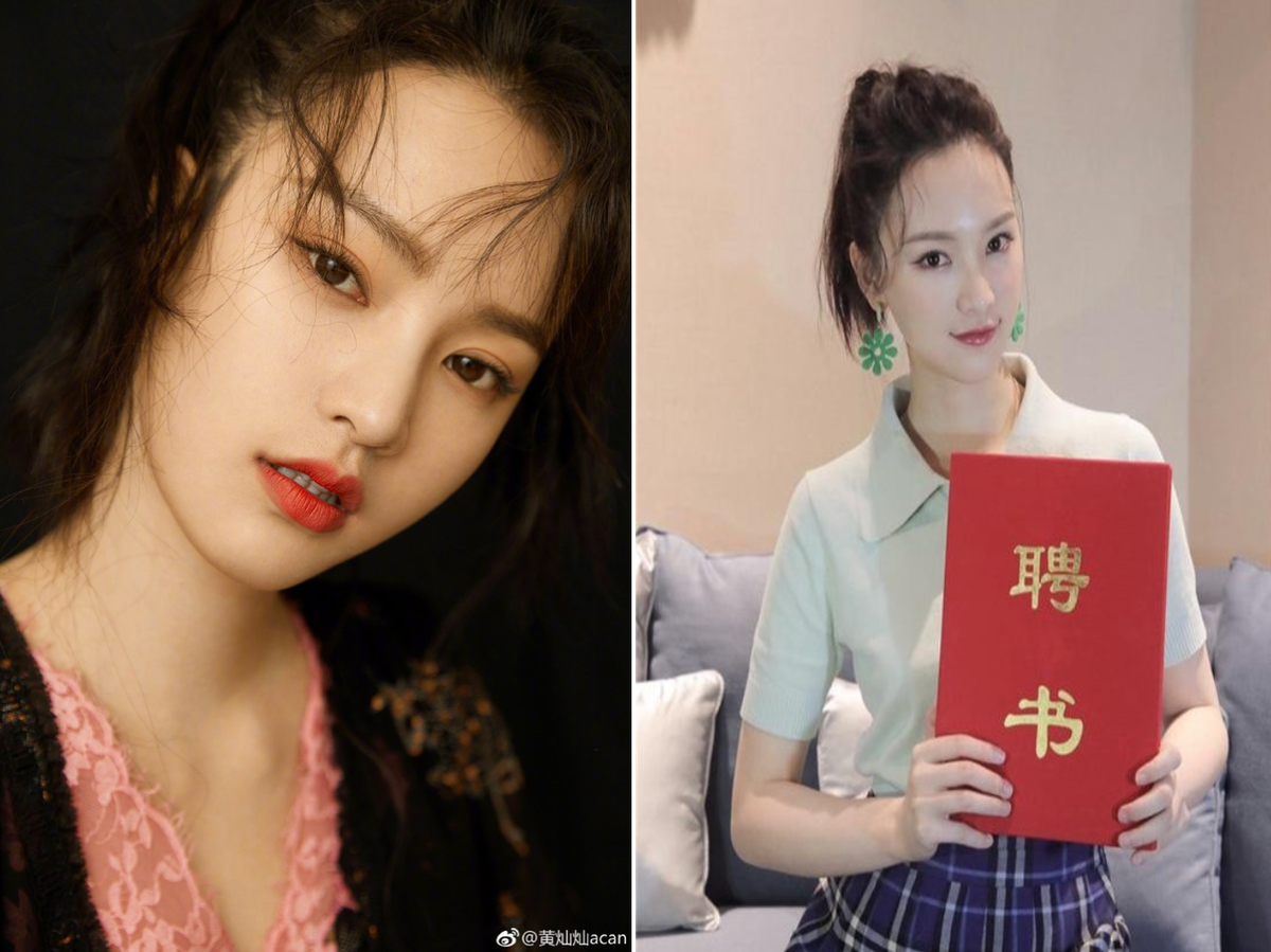 Bên cạnh đó, Xán Xán cũng dính nghi án can thiệp thẩm mỹ để có ngoại hình sắc sảo hơn. Nhiều dân mạng so sáng loạt ảnh của 9X thời mới nổi và khi gia nhập giới giải trí thấy phần trán cô căng, đầy hơn, sống mũi cũng cao hơn hẳn. Tuy nhiên, nữ sinh Vũ Hán chưa từng lên tiếng về các tin đồn này. Nhưng dễ dàng nhận ra gương mặt của cô có nhiều khoảnh khắc sưng vù, cứng đơ, hậu quả của can thiệp dao kéo.