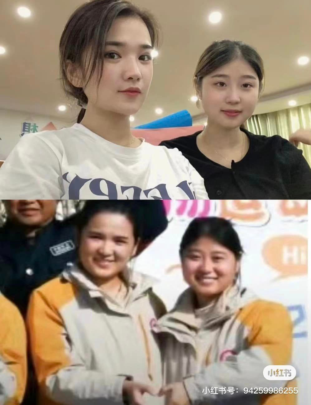 Tình trạng này được nhiều người gọi là "hội chứng zombie", hay "hội chứng thây ma".