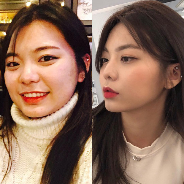 Khuôn mặt của hot girl giảm cân Seungjin cũng trở nên thon gọn, xinh đẹp hơn.