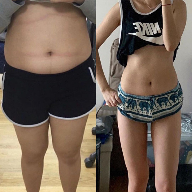 Từng nặng hơn 70kg, hot girl giảm cân thành công Yang Seungjin tự ti với thân hình mũm mĩm và vòng eo bánh mì kém xinh.