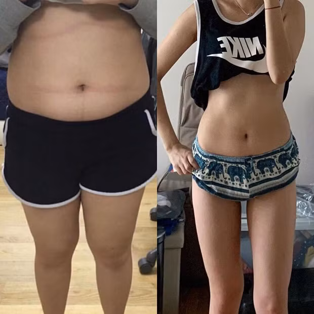 Từng nặng hơn 70kg, hot girl giảm cân thành công Yang Seungjin tự ti với thân hình mũm mĩm và vòng eo bánh mì kém xinh.