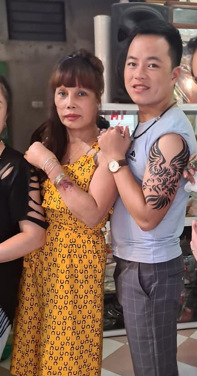 Điều khiến mọi người chú ý hơn cả chính là gương mặt hốc hác với khuôn miệng vẫn còn lệch của cô dâu 62 sau khi tháo băng được chia sẻ trên trang cá nhân khác xa với hình ảnh gương mặt cân đối, trẻ trung, làn da mịn màng sau phẫu thuật mà cô vẫn chia sẻ.