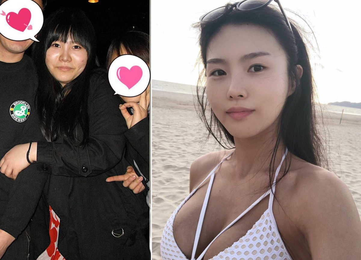 Cùng với phương pháp giảm cân lành mạnh, cô nàng không chỉ cải thiện vóc dáng mà còn nâng cao sức khỏe toàn diện, da dẻ cũng đẹp mịn màng, hết sạch mụn.