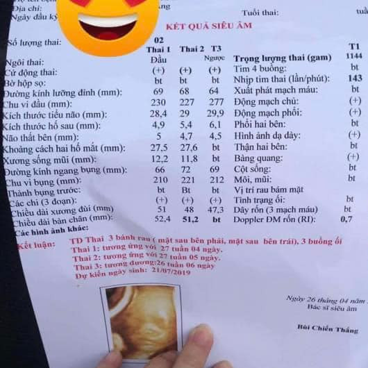 Câu chuyện sinh ba của vợ chồng anh Đông - chị Huyền ở Tiên Lãng, Hải Phòng khiến những người dân sống xung quanh không ai là không biết đến. Cặp vợ chồng quen biết nhau một cách rất tình cờ.