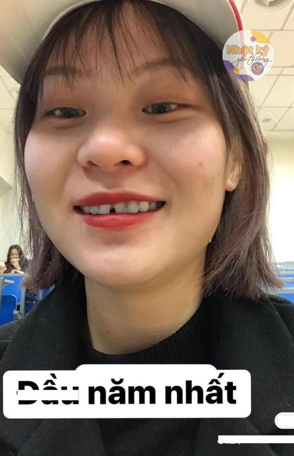 Hình ảnh của bạn nữ vào đầu năm nhất với nhan sắc khá nhạt nhòa, điểm đặc biệt làm nhiều người chú ý là hàm răng với 2 chiếc răng cửa khá thưa nhau.