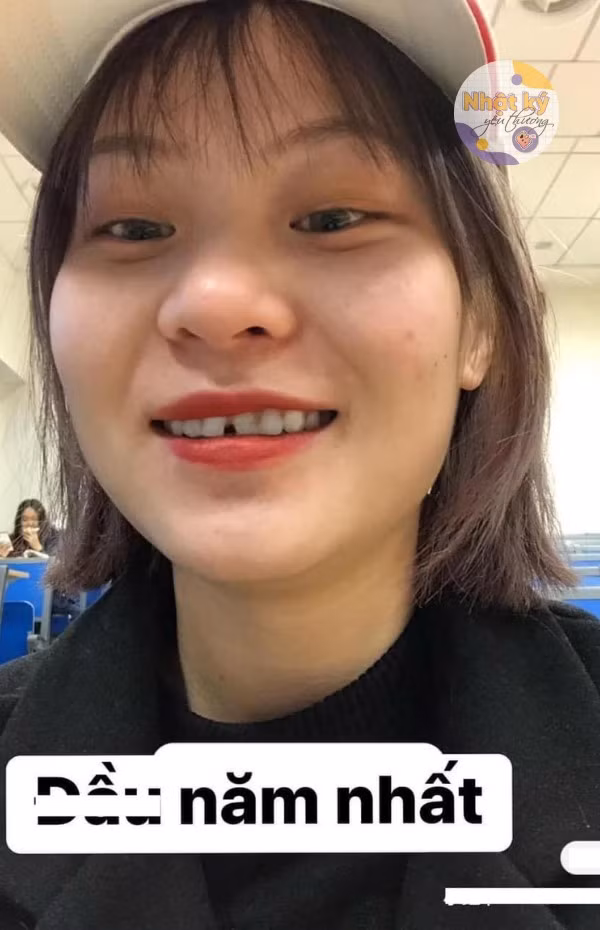 Hình ảnh của bạn nữ vào đầu năm nhất với nhan sắc khá nhạt nhòa, điểm đặc biệt làm nhiều người chú ý là hàm răng với 2 chiếc răng cửa khá thưa nhau.